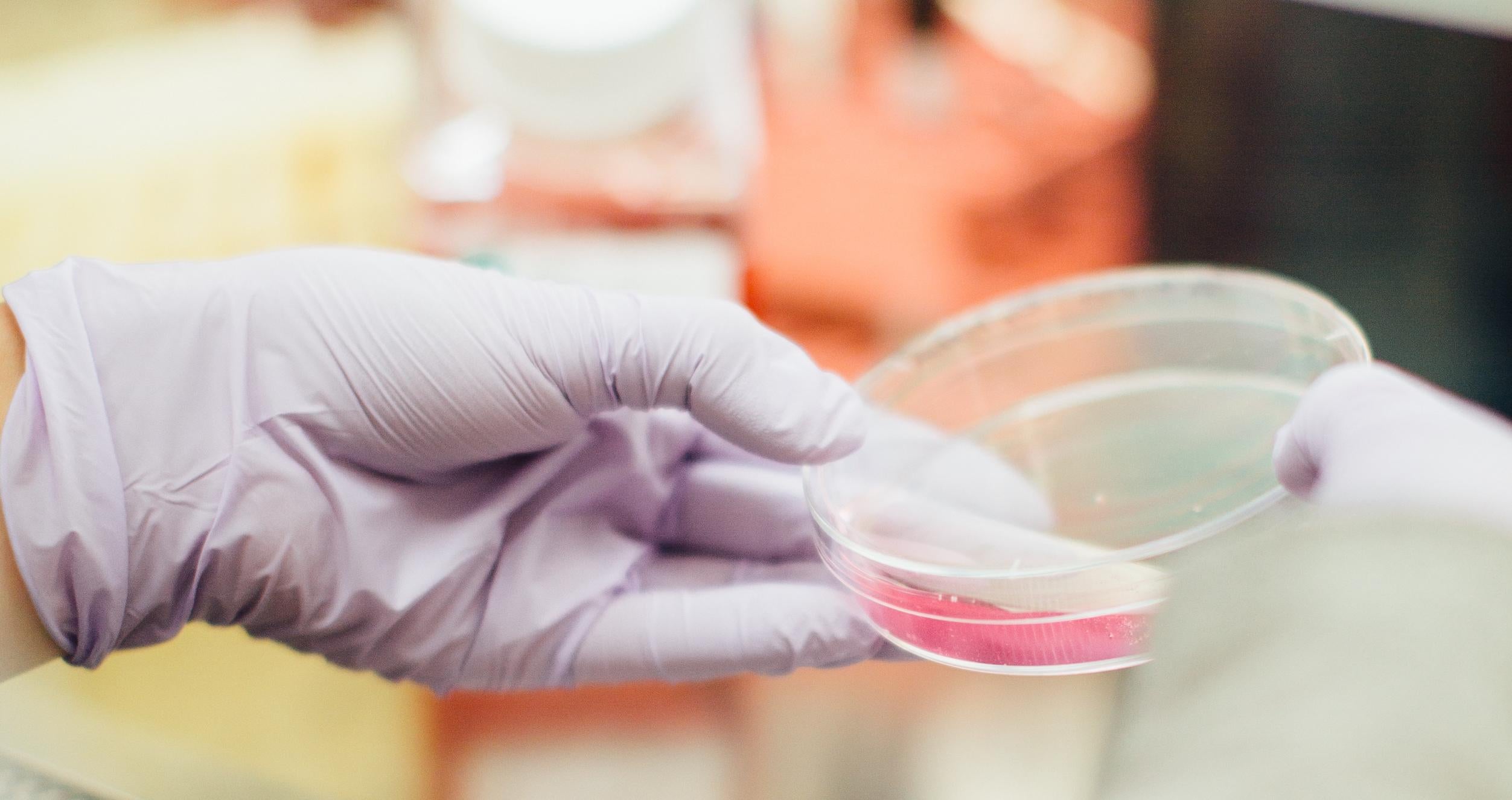 Gloved lab technician's hands holding petri dish with pink fluid  